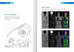 西藏康城腫瘤醫(yī)院開展MR類PET成像技術(shù)